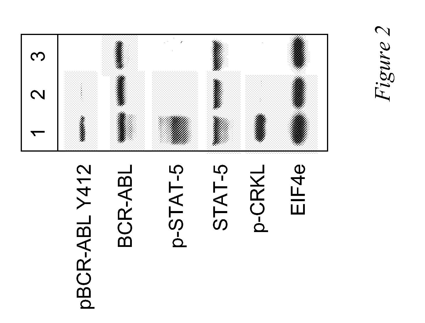 Use of a Kinase Inhibitor for the Treatment of Particular Resistant Tumors