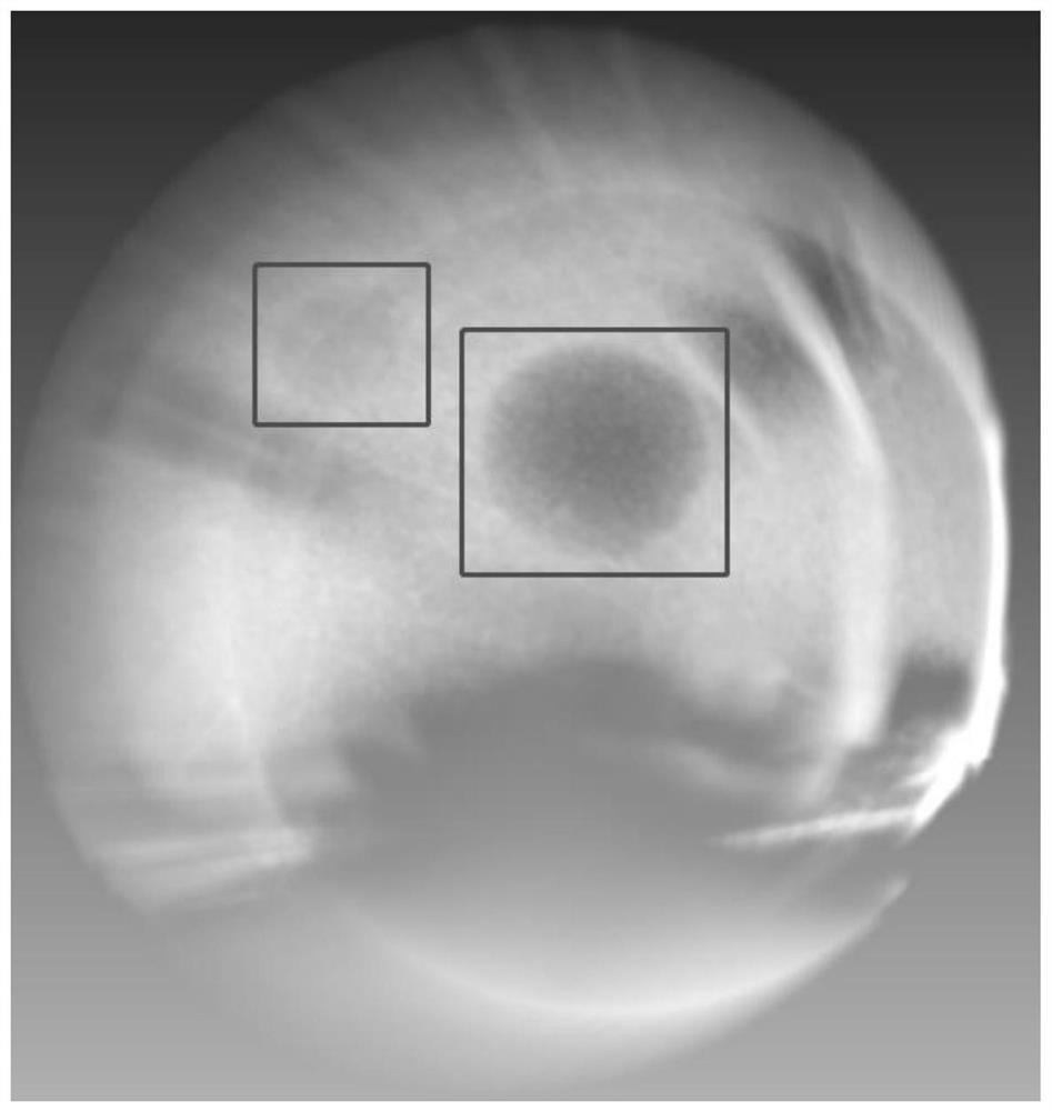 Anti-artifact feature extraction method based on ultrasonic tomography reflection image convex target