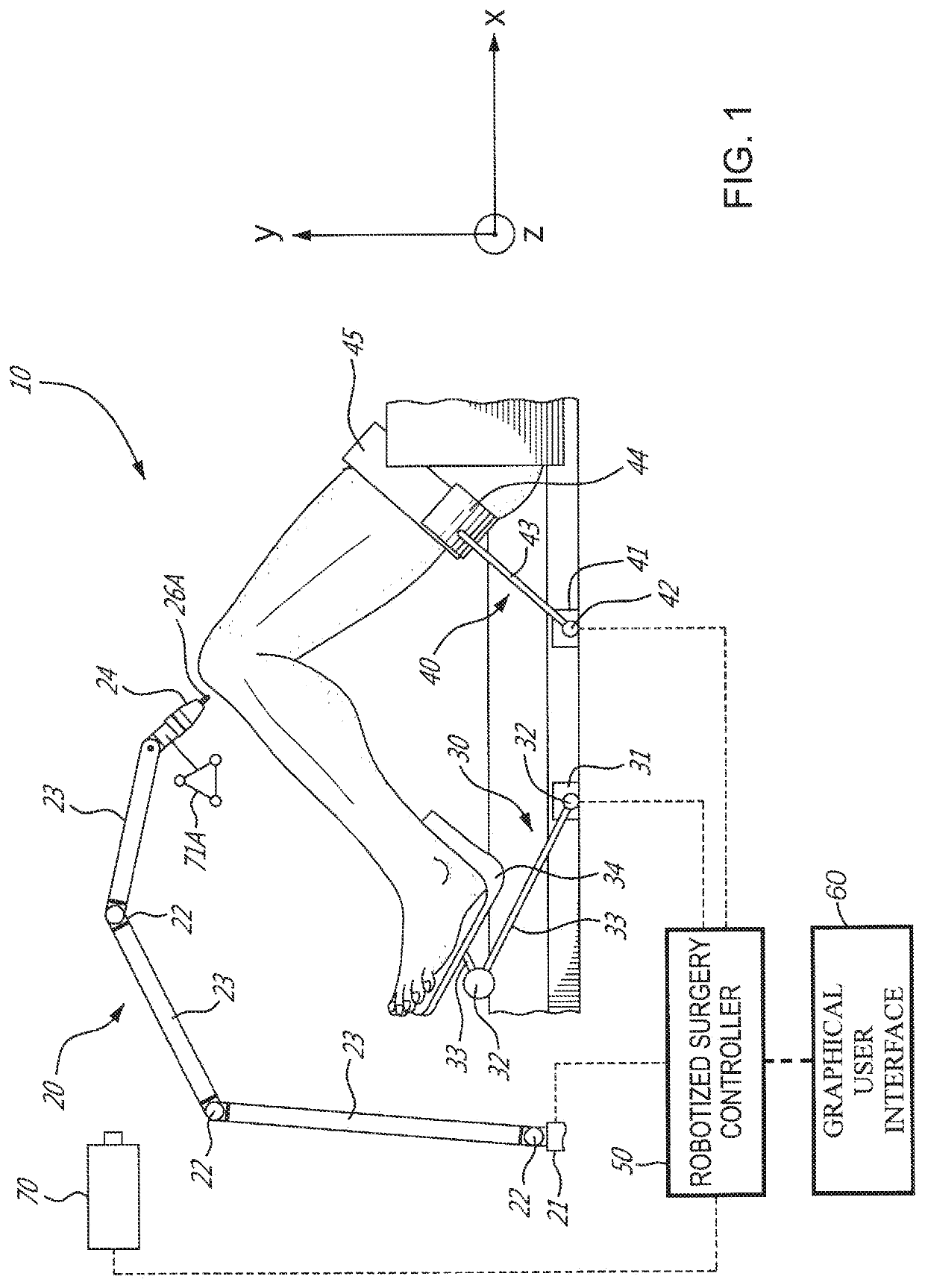 Method and system for validating bone alterations in computer-assisted surgery