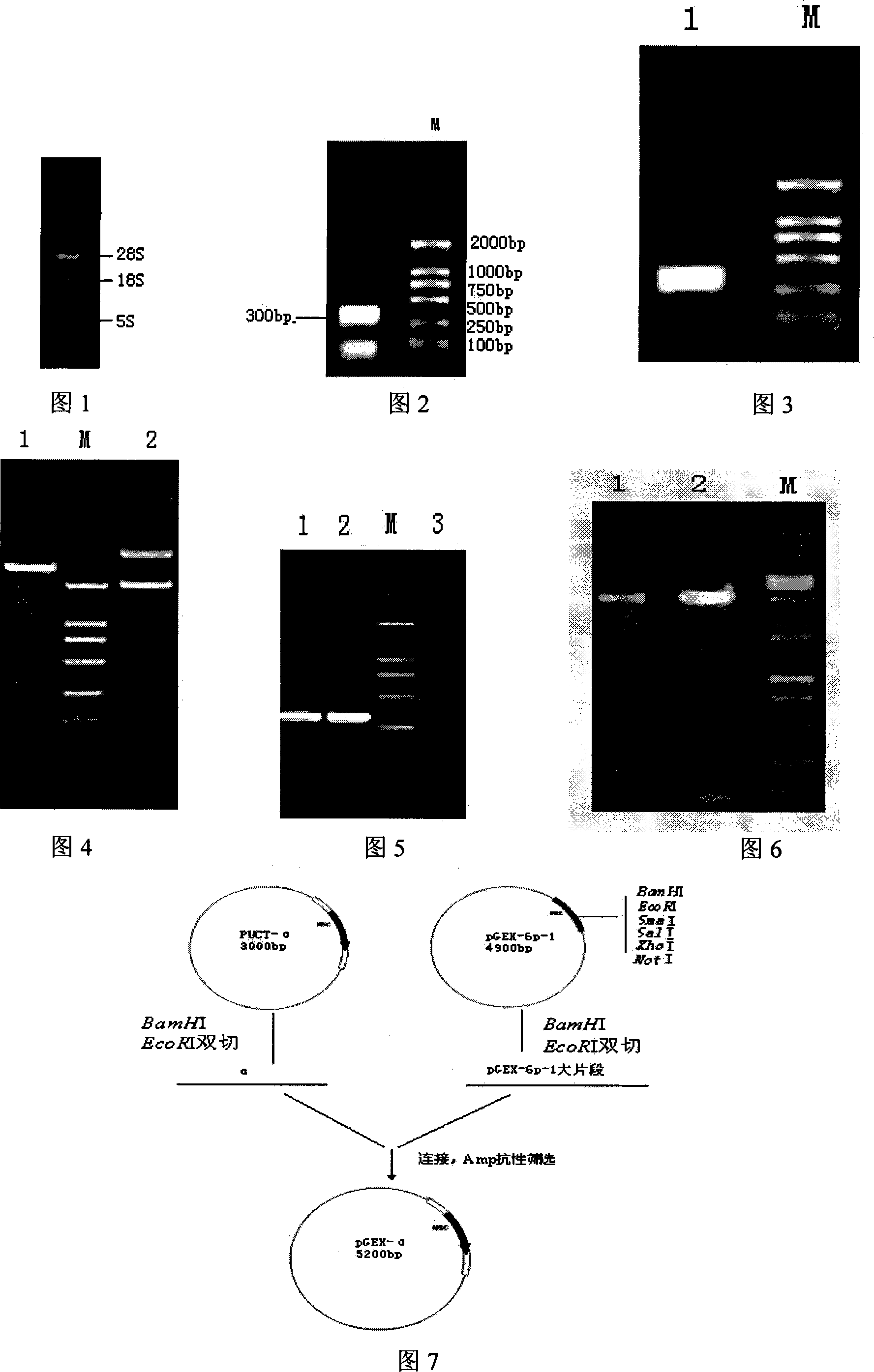 Preparation method of fused protein for antioxidation and preventing diabetes and application thereof