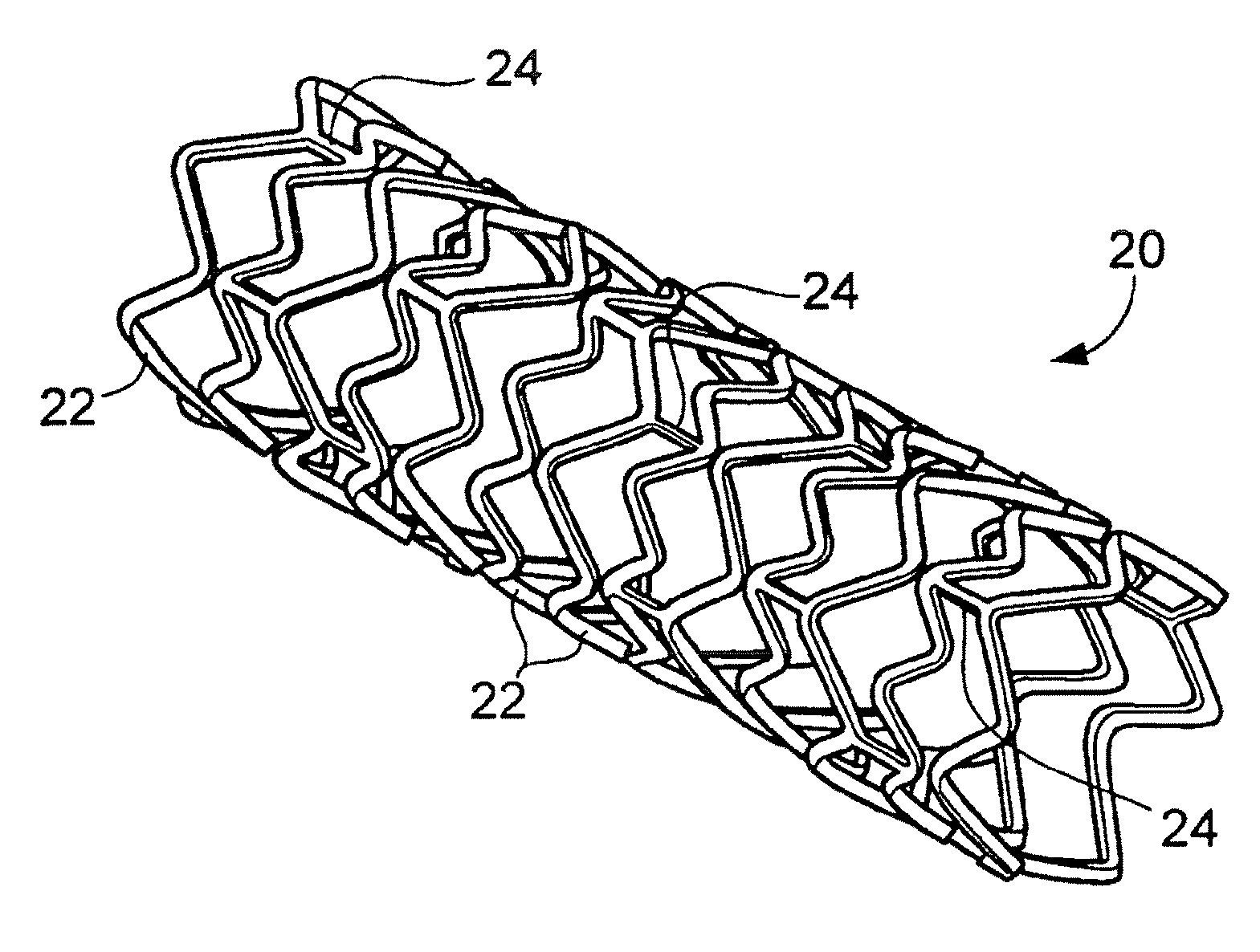 Stents with ceramic drug reservoir layer and methods of making and using the same