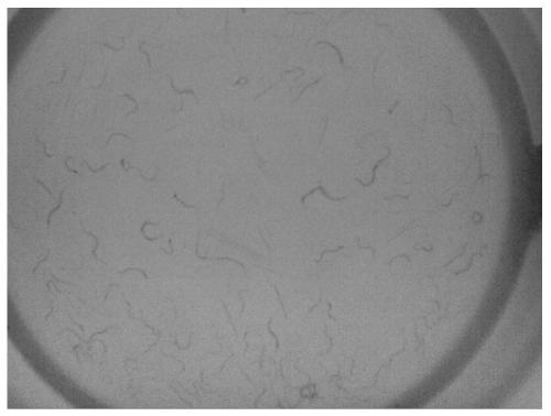 Estimation Method of Microorganism Quantity Based on Image Processing