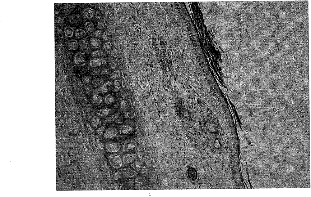 Nicotinylmethylamide freeze-dried powder preparation for injection and preparation method thereof