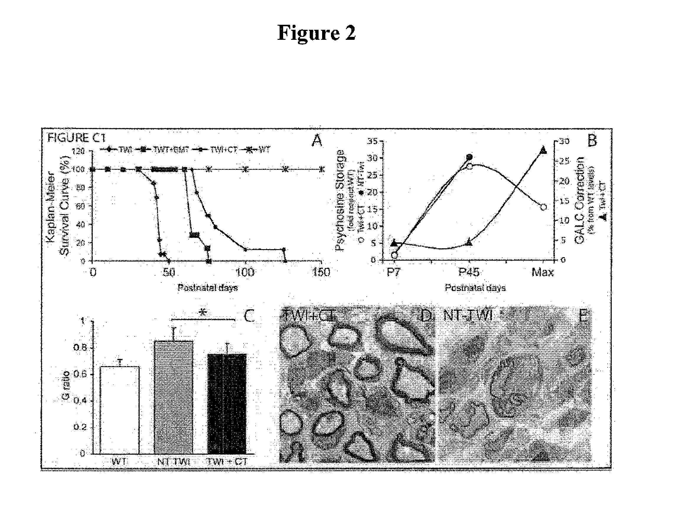 Compositions and methods for the treatment of krabbe and other neurodegenerative diseases