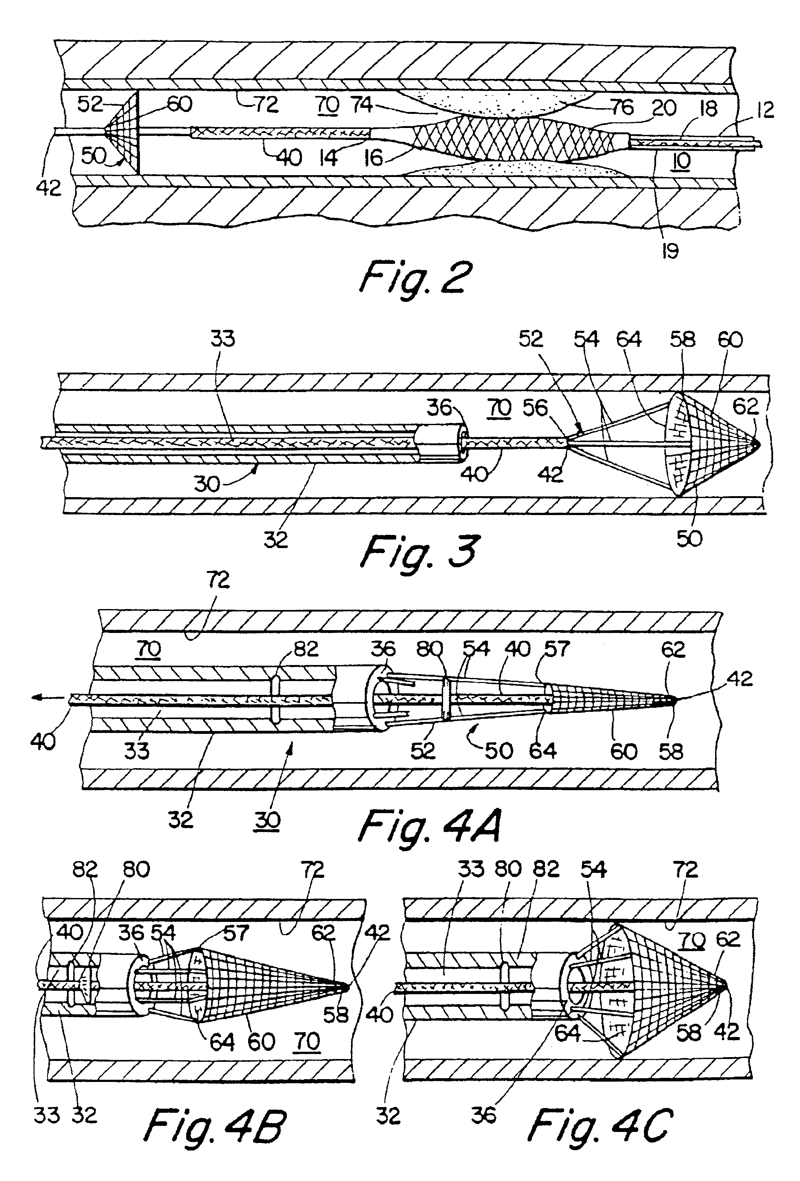 Percutaneous catheter and guidewire having filter and medical device deployment capabilities