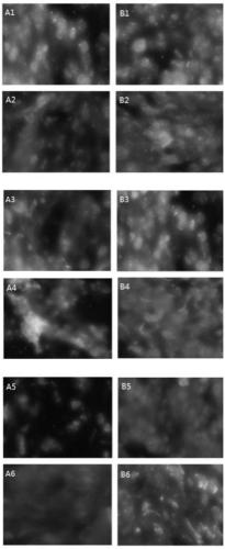 Preparation method of FISH probe of TOP2A gene