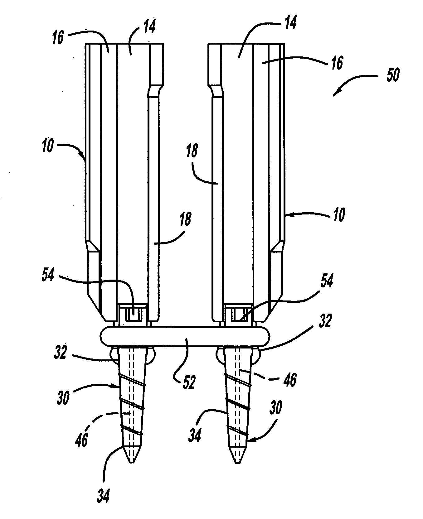 Pedicle screw and rod system for minimally invasive spinal fusion surgery