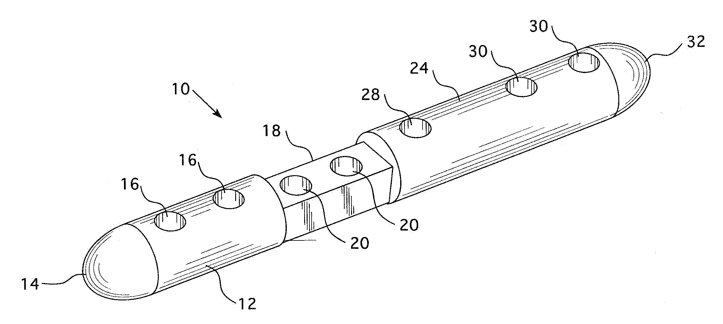 Intramedullary Nail