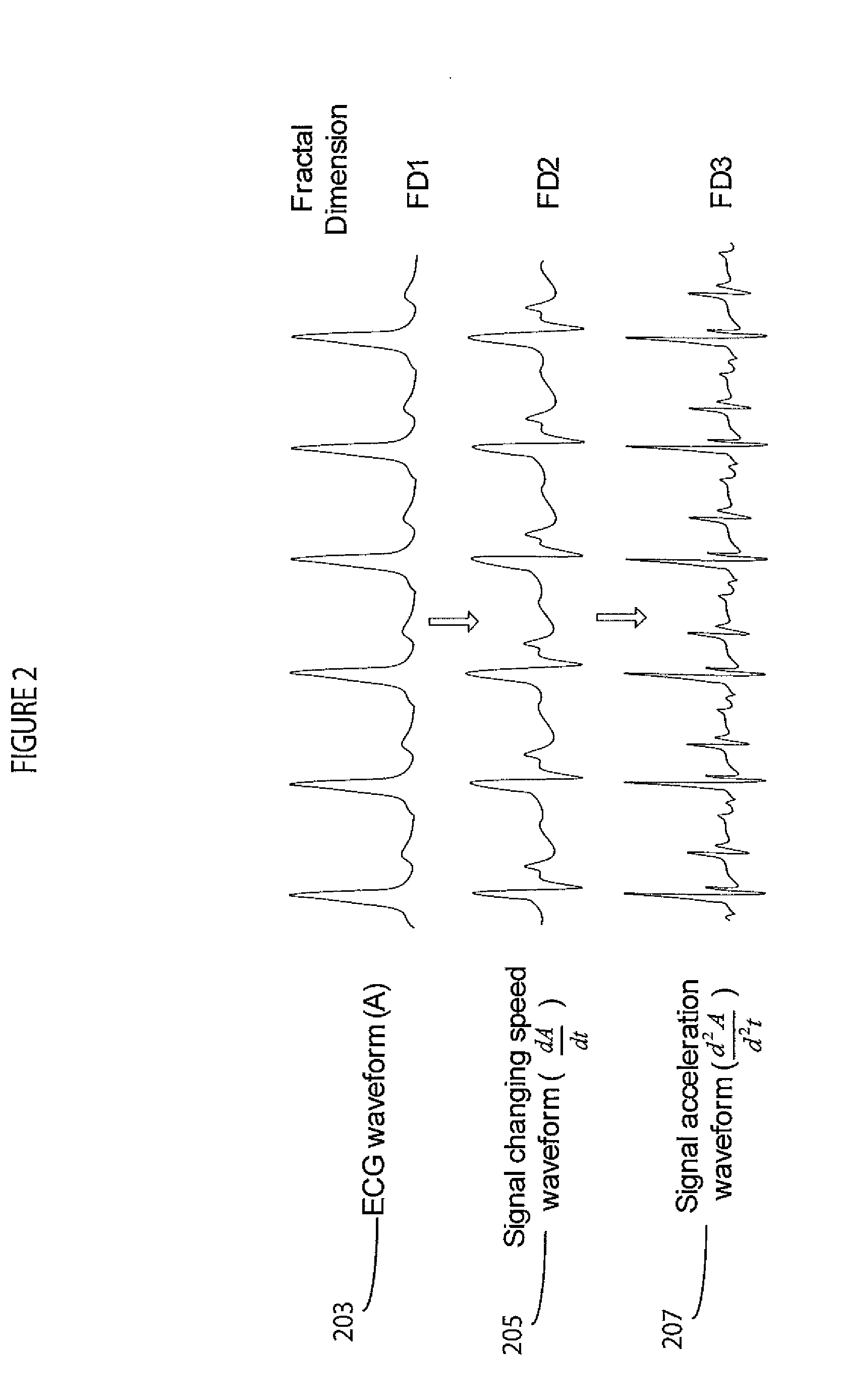 System for Continuous cardiac pathology detection and characterization