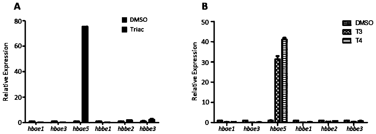 Application of thyroid hormone and analogue thereof in preparation of drugs for treating sickle-cell disease