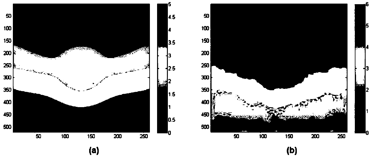 Method and system for displacement estimation of ultrasonic elastography, terminal and readable storage medium