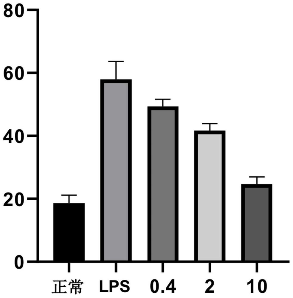 Pharmaceutical composition containing papaverine and paeoniflorin and application of pharmaceutical composition