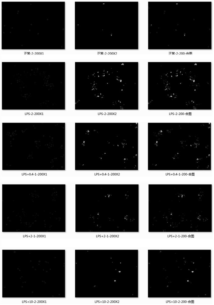 Pharmaceutical composition containing papaverine and paeoniflorin and application of pharmaceutical composition