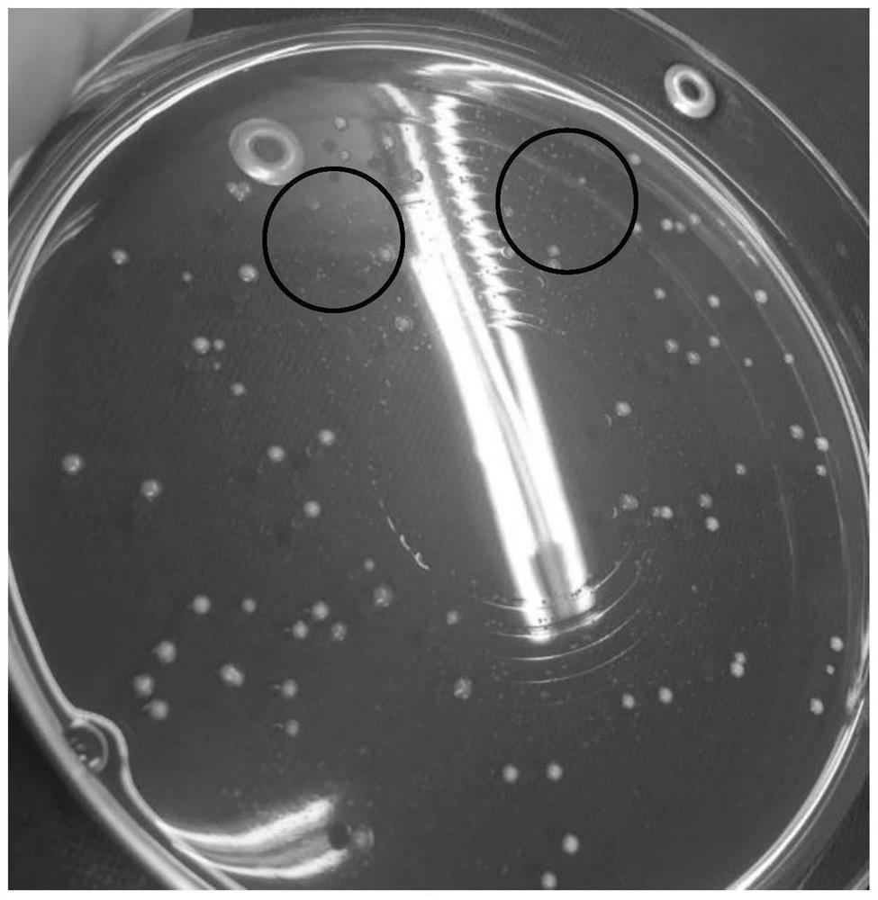 A culture medium and detection method for detecting bifidobacteria