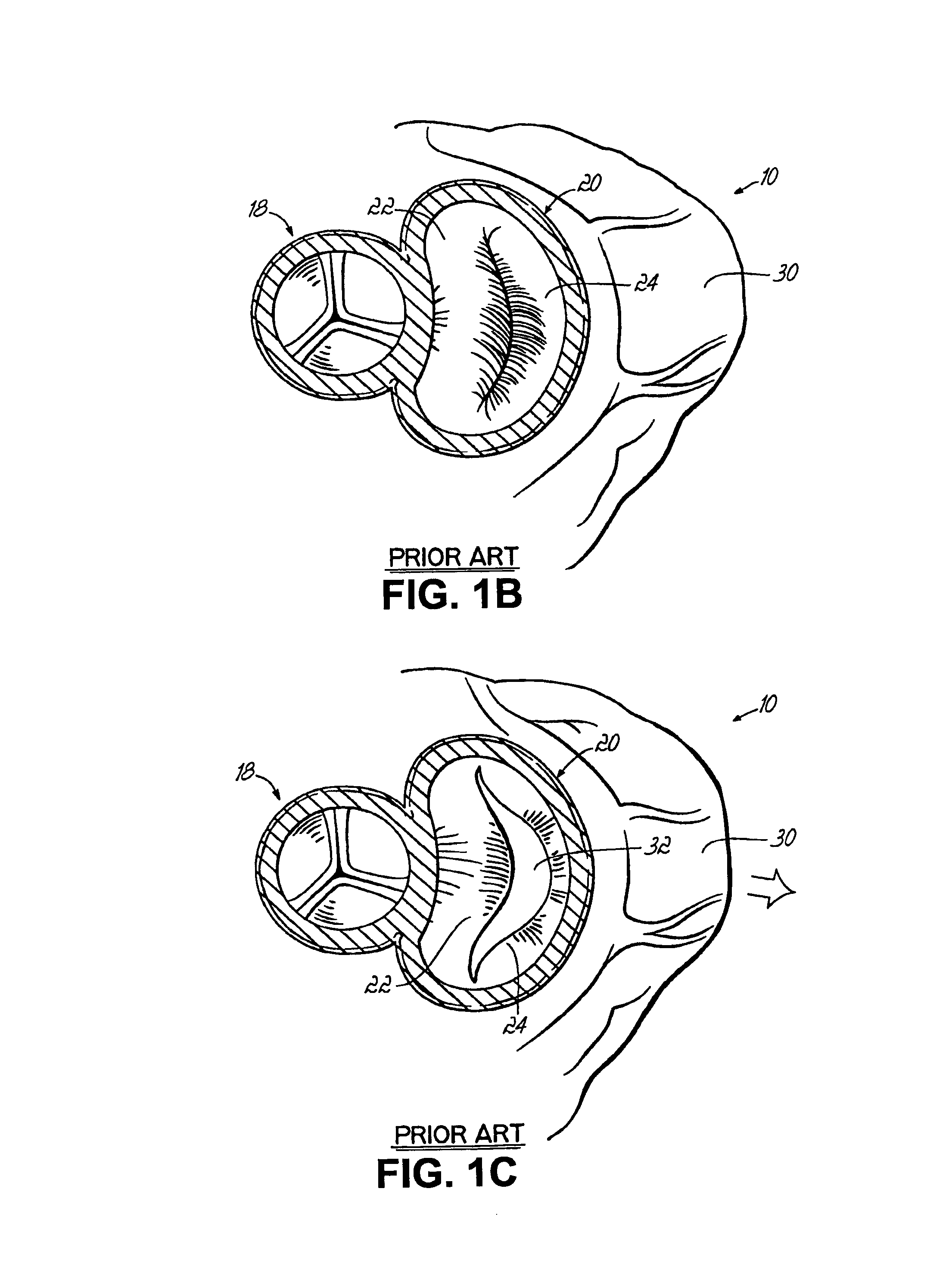 Tissue fastening systems and methods utilizing magnetic guidance