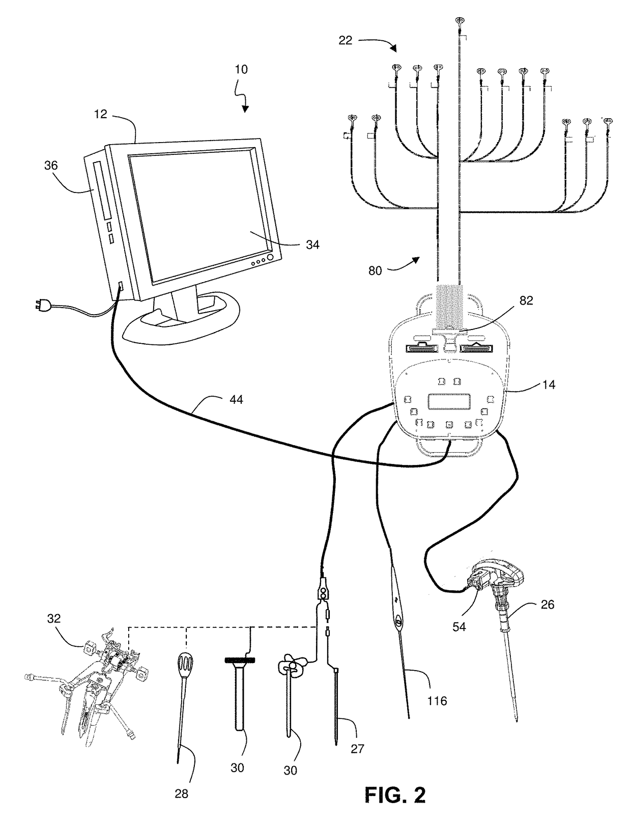 Waveform marker placement algorithm for use in neurophysiologic monitoring