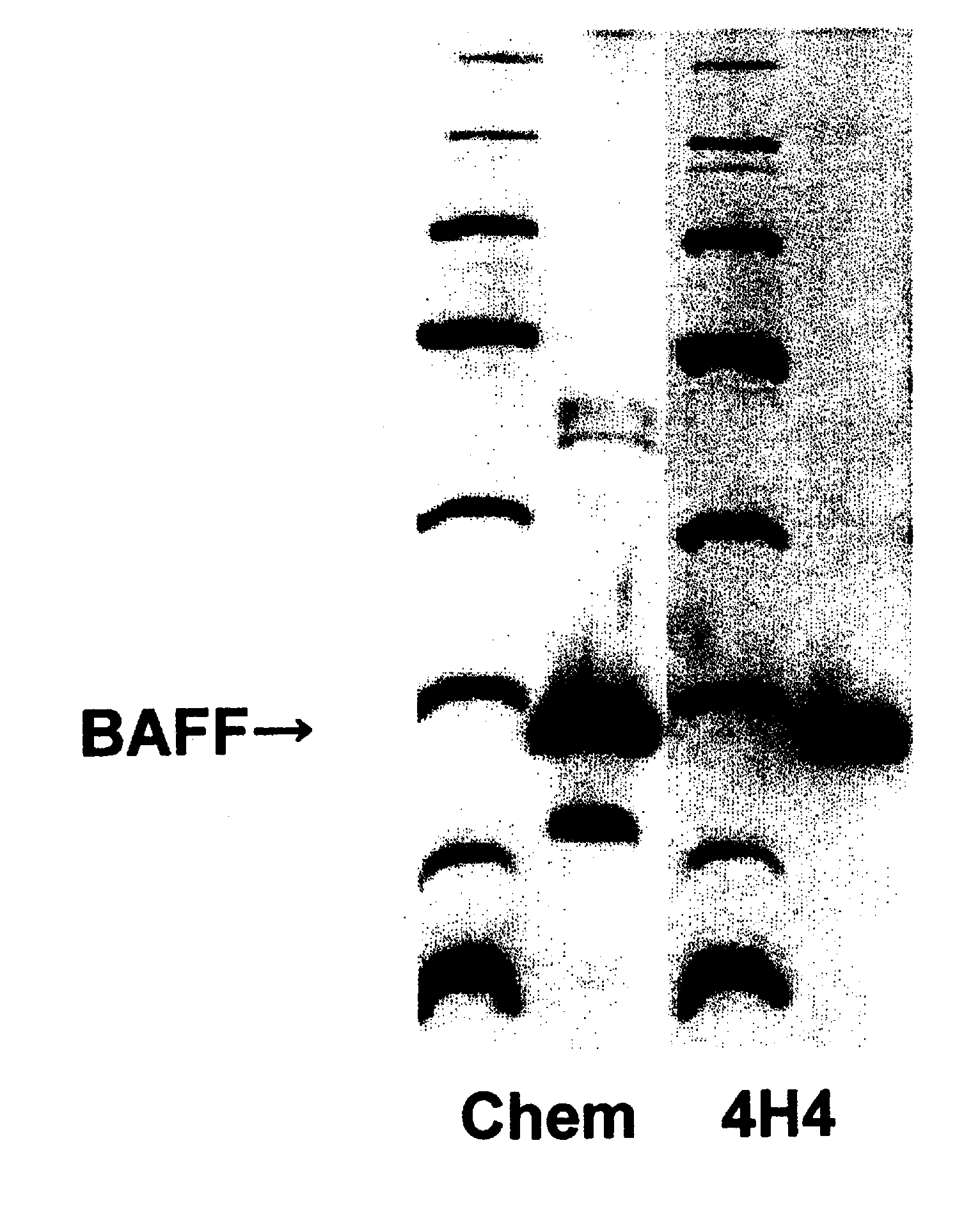 Antihuman baff antibody