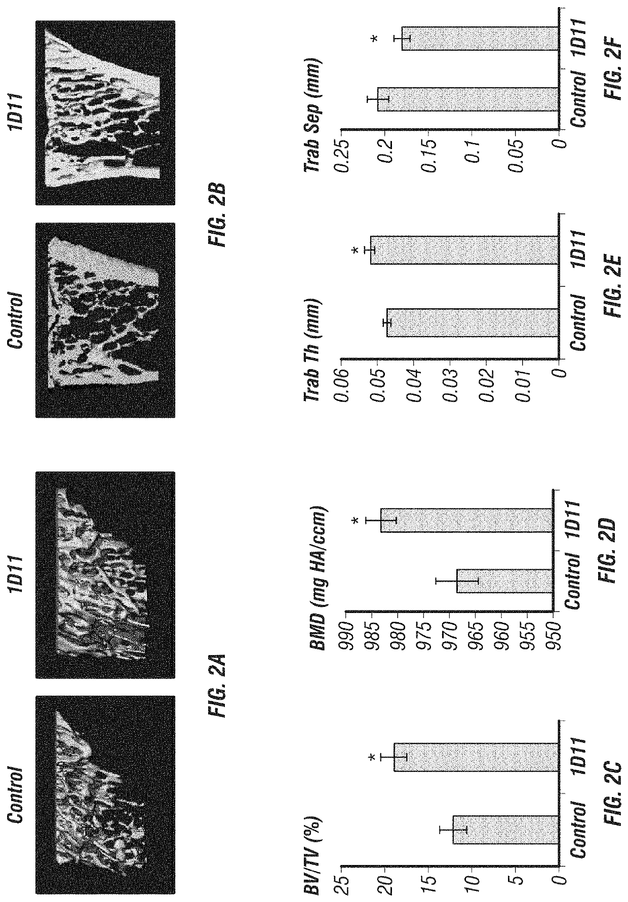 Anti-TGF-β induction of bone cell function and bone growth