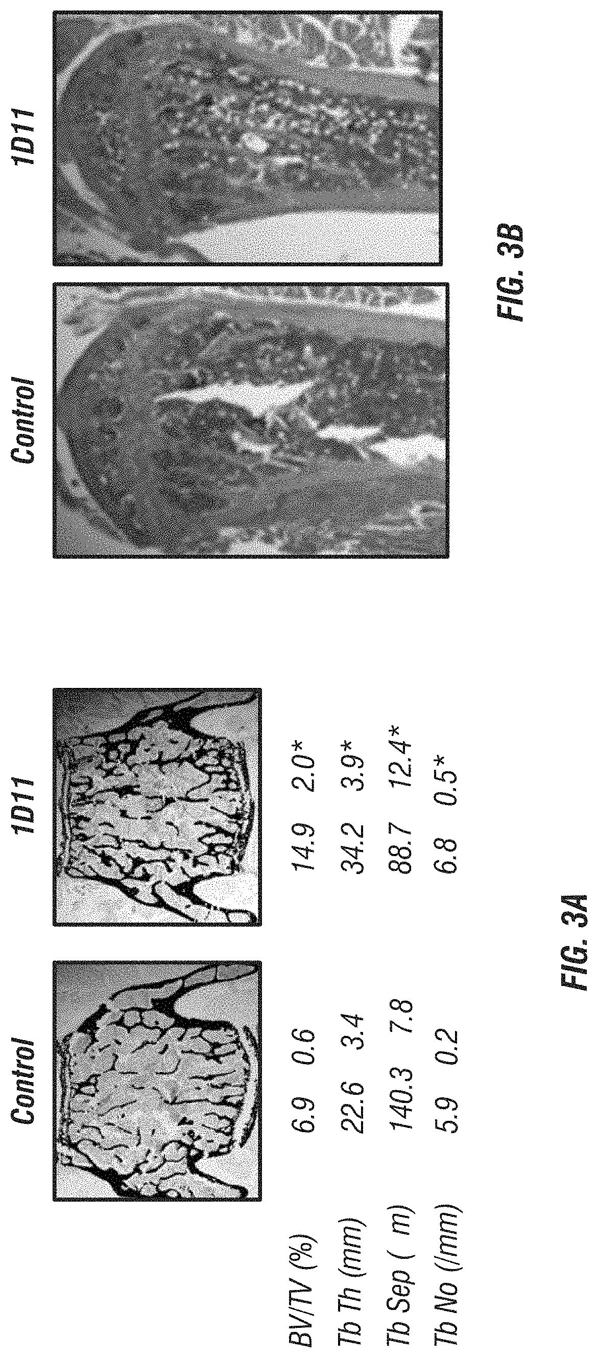 Anti-TGF-β induction of bone cell function and bone growth