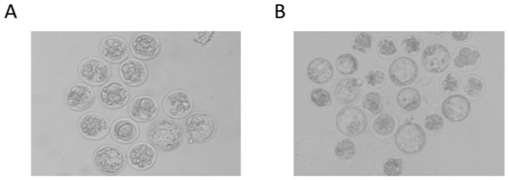 Application of DNA methyltransferase inhibitor in improvement of animal round sperm injection embryo development efficiency