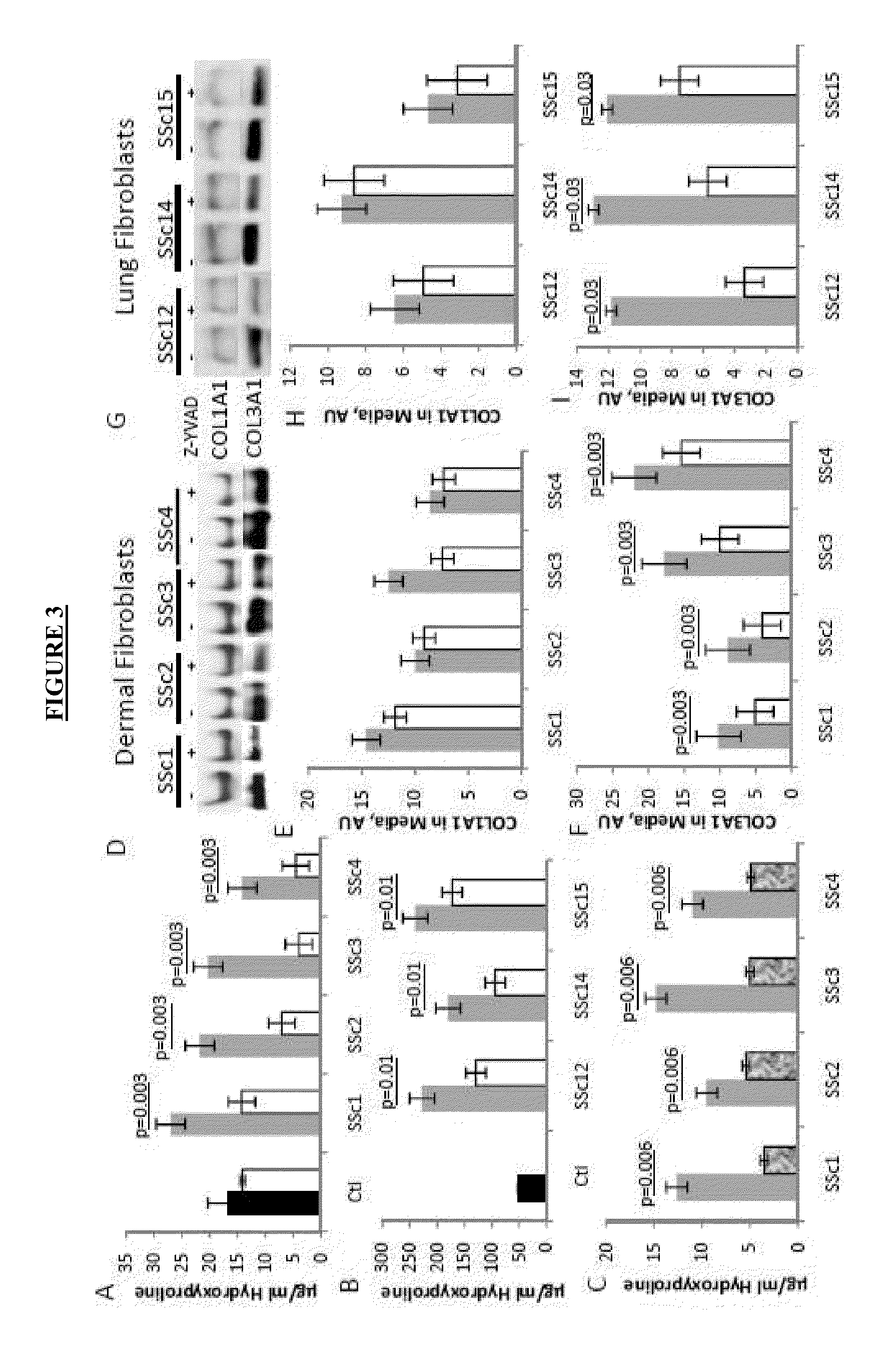 Methods for treating or preventing fibrosis in subjects afflicted with scleroderma