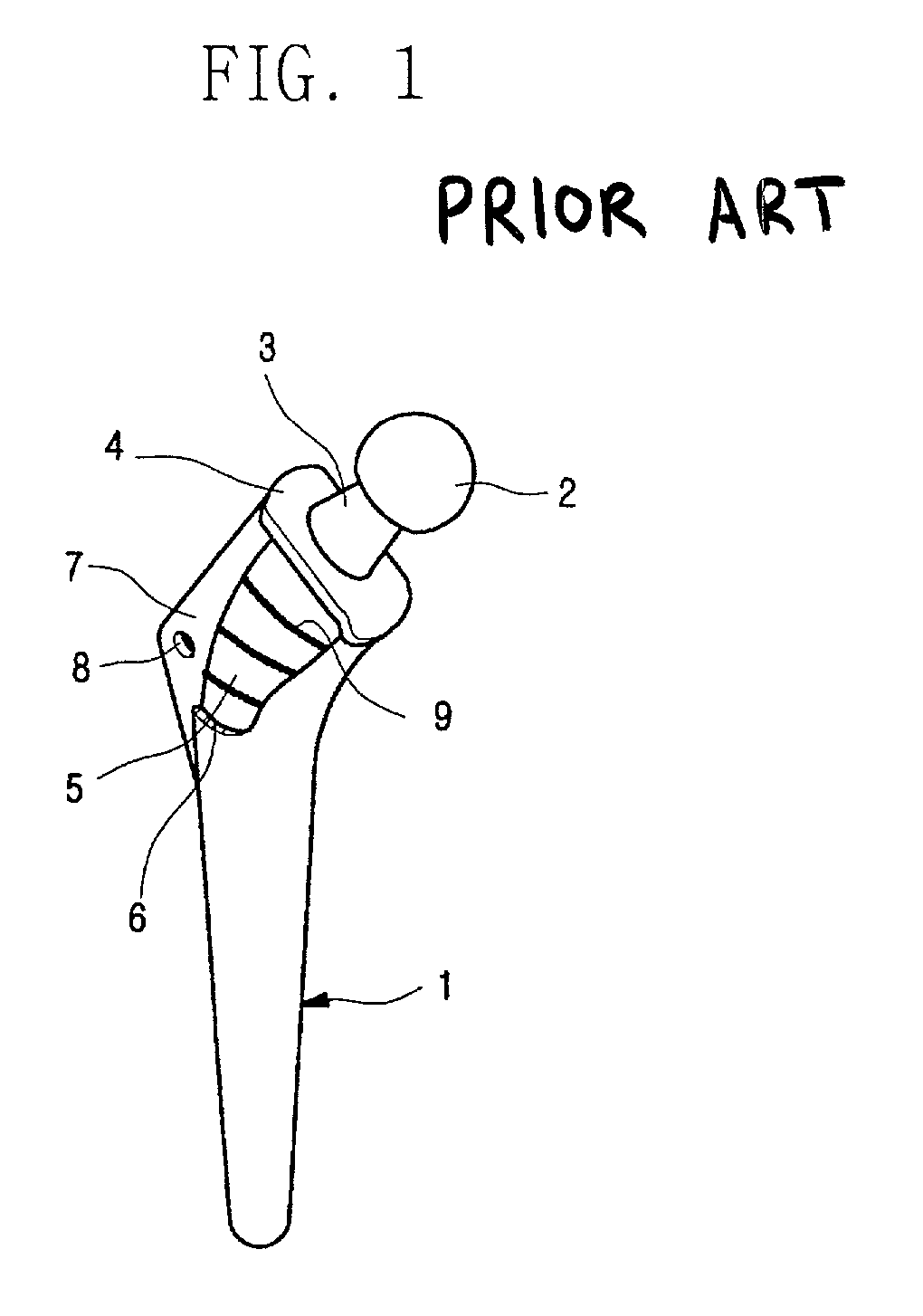 Cement jacket for a cemented artificial joint stem and artificial joint having the cement jacket