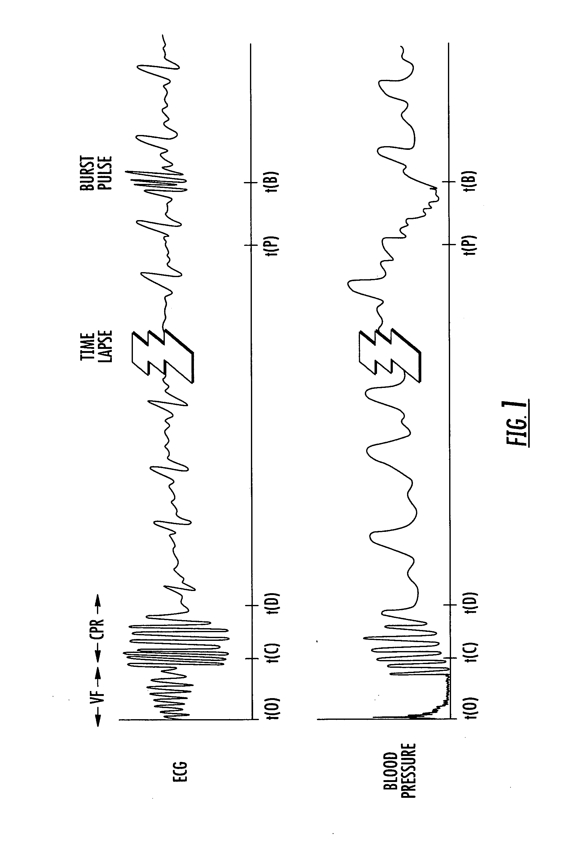 Method and system for reducing cardiac low pressure states