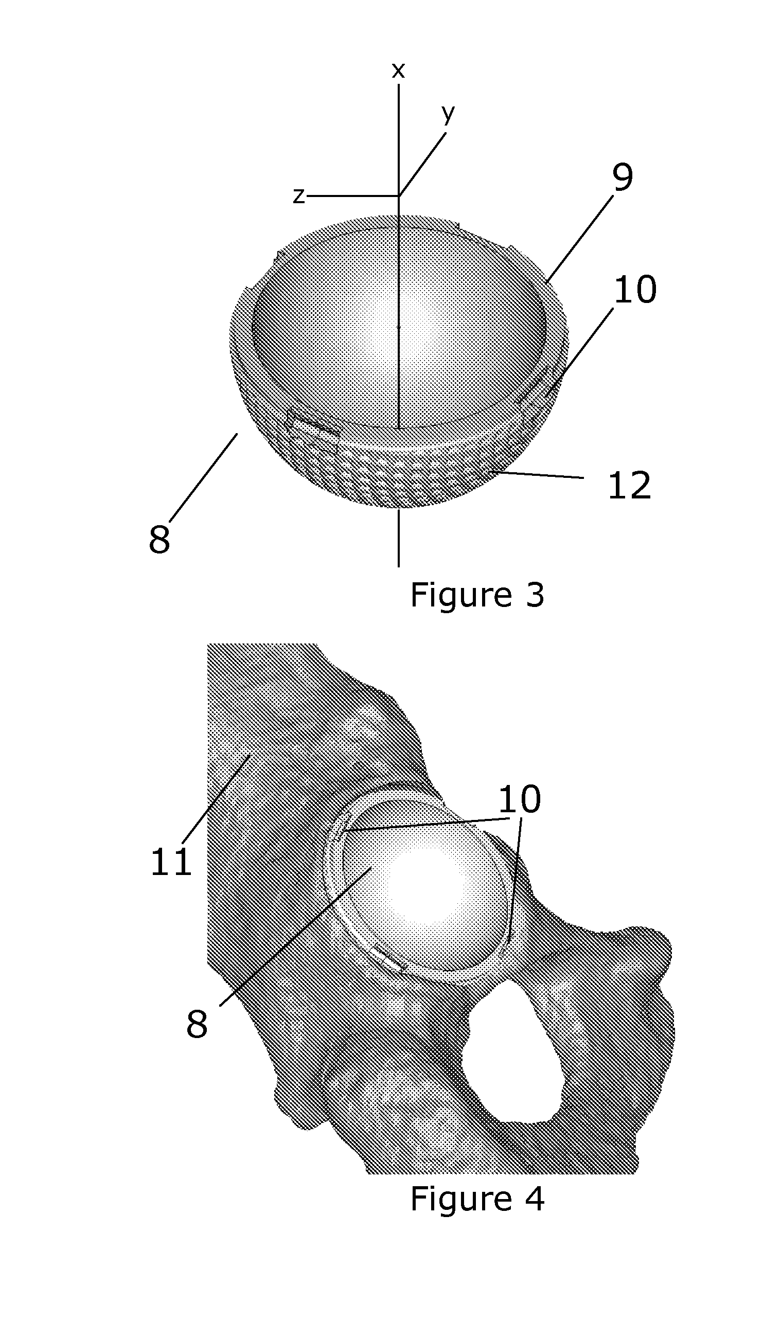 Guiding instruments and impactors for an acetabular cup implant, combinations thereof, methods for manufacturing and uses thereof
