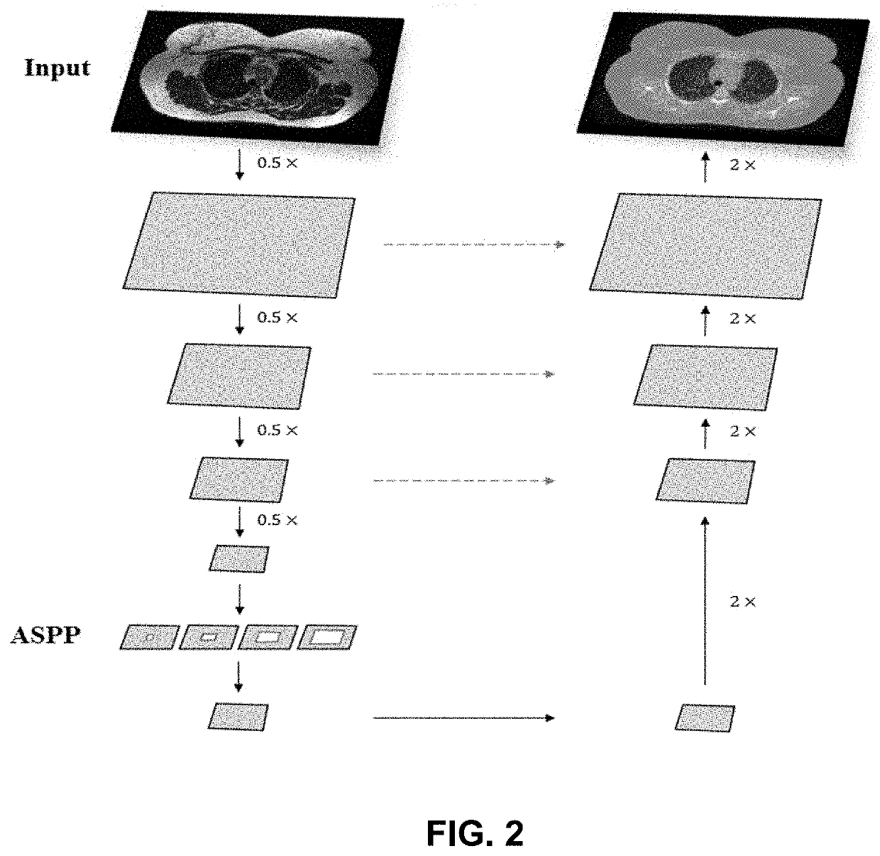 Ml-based methods for pseudo-ct and hr mr image estimation