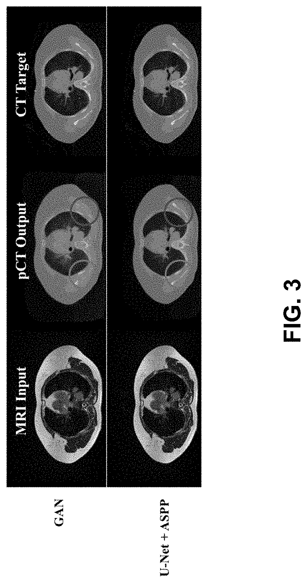 Ml-based methods for pseudo-ct and hr mr image estimation