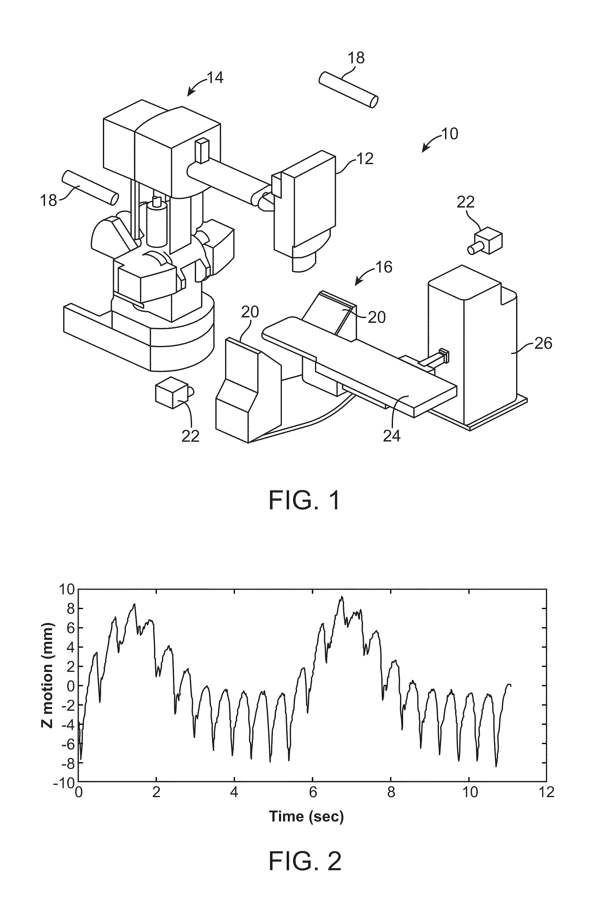 Heart Treatment Kit, System, and Method For Radiosurgically Alleviating Arrhythmia