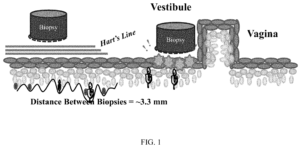 Treatment of vulvar pain