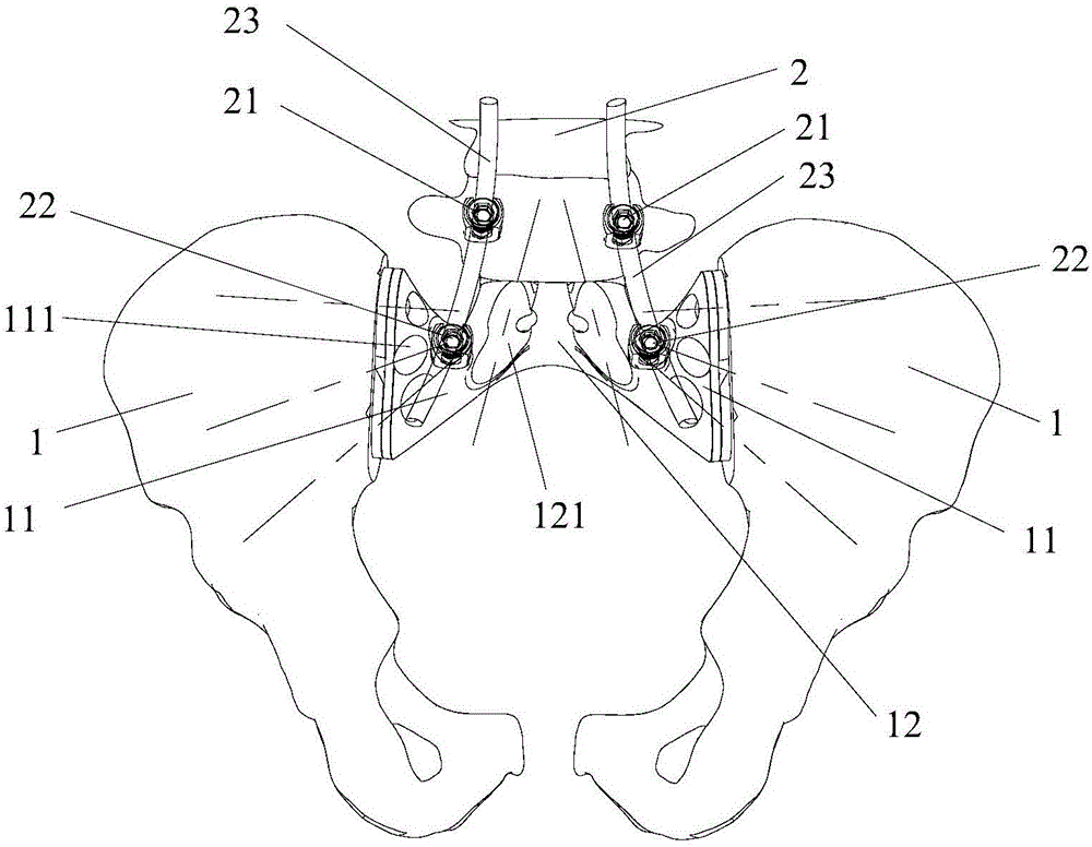 Sacrum prosthesis