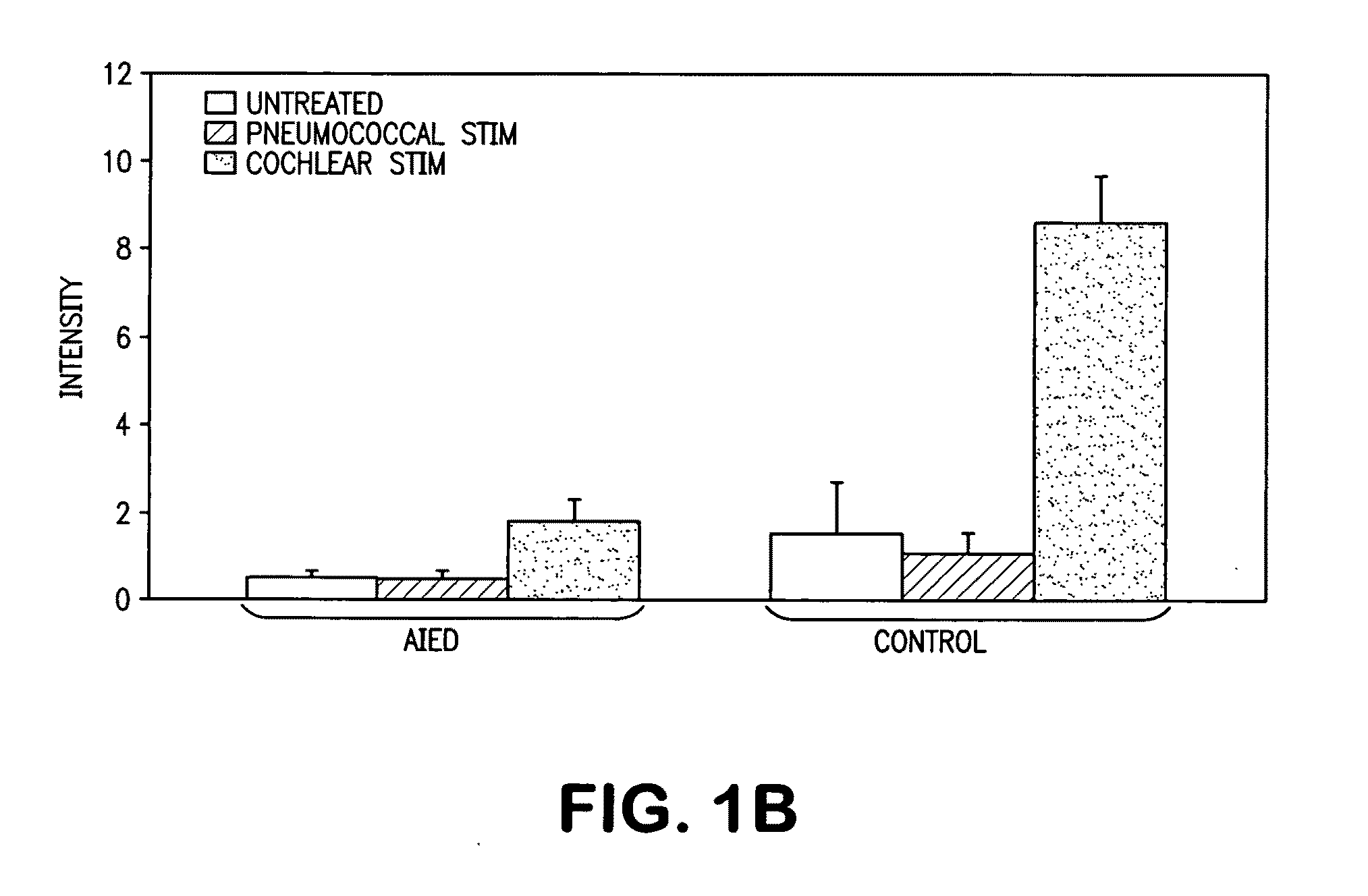 Methods of predicting steroid responsiveness with Il-1RII