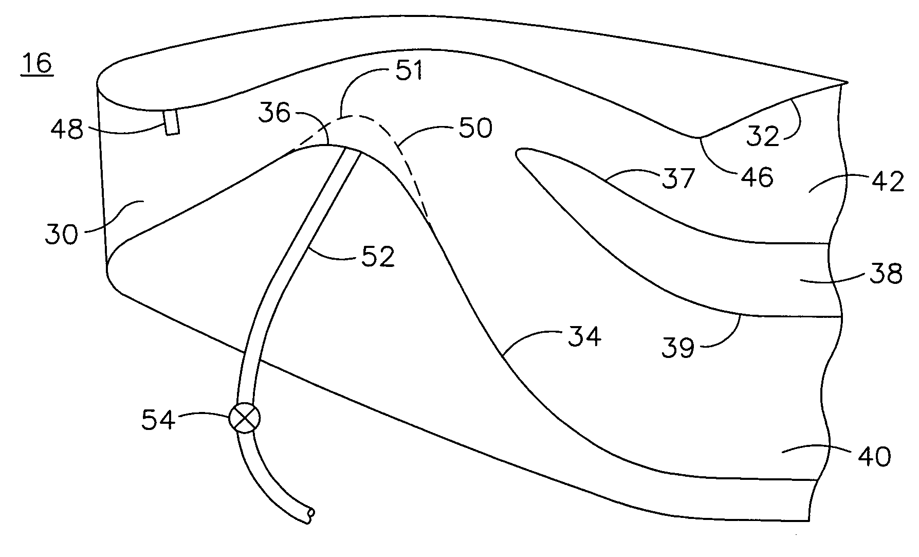 Adaptive inertial particle separators and methods of use