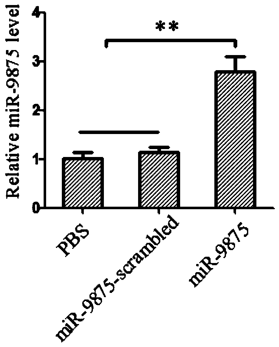 Application of antisense nucleic acid AMO-miR-9875 in the preparation of anti-white spot syndrome virus preparations