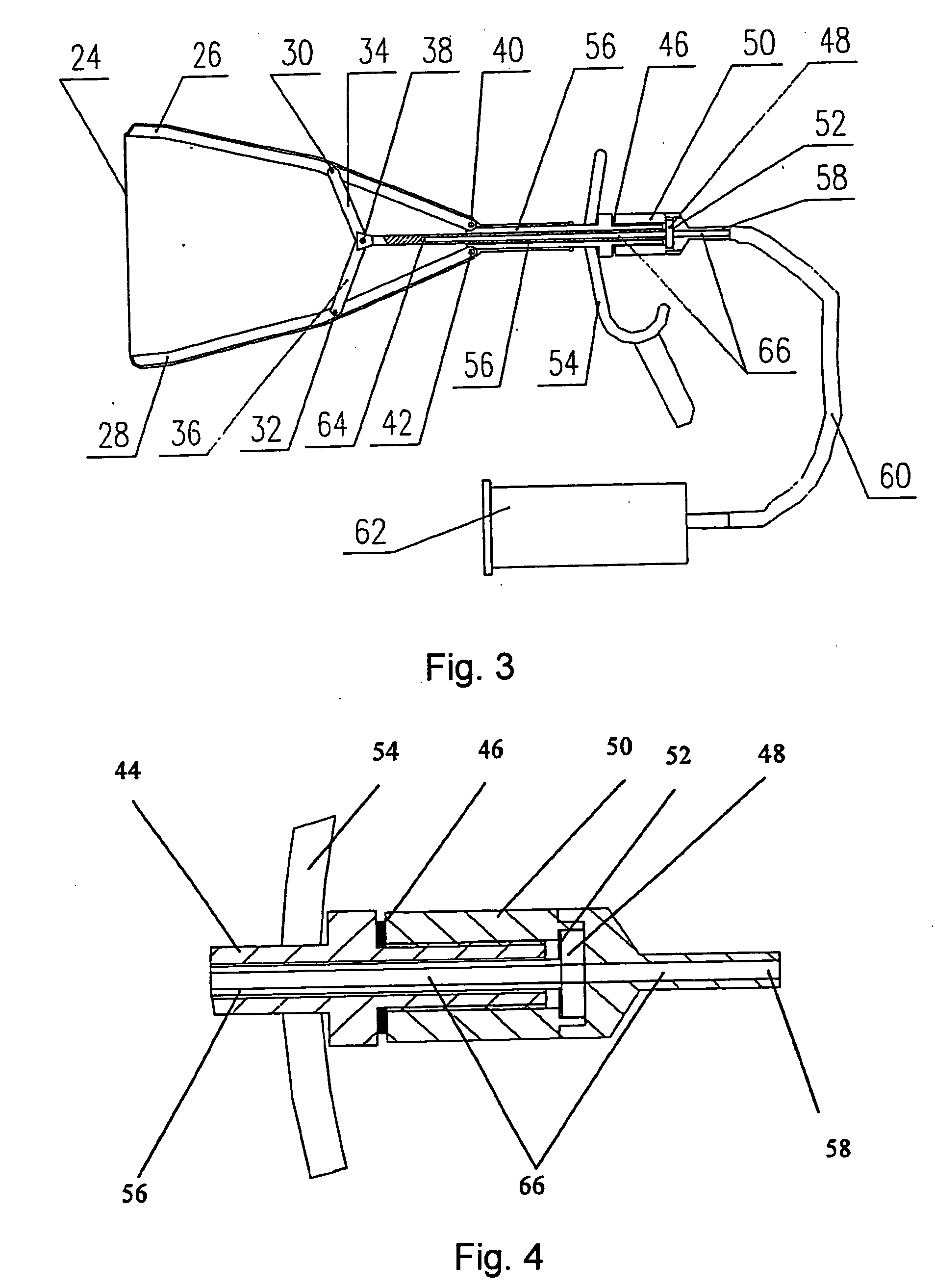 Apparatus for Body Cavity Delivery with Medium, Body Cavity Leading-in and Ultrasound Block
