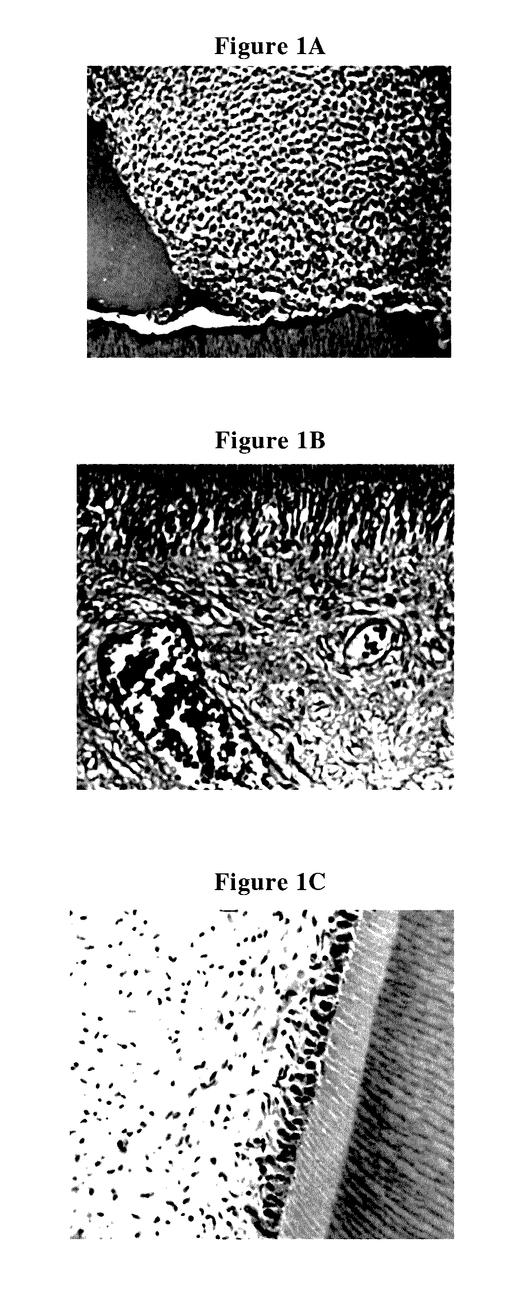 Combination of growth factors, cytokines, antibacterial/antiviral factors, stem cell stimulating factors, complement proteins C3A/C4A, and chemotactic factors