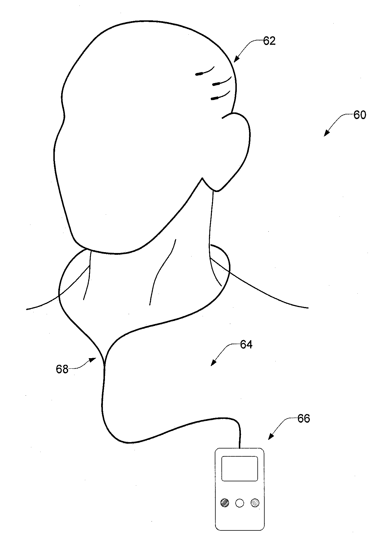 Implantable Systems and Methods for Identifying a Contra-ictal Condition in a Subject