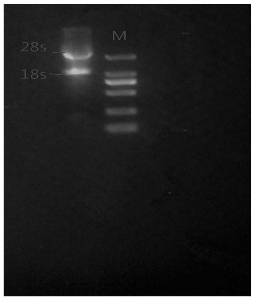 Anti-amantadine amd single-chain antibody scfv and its preparation method and application