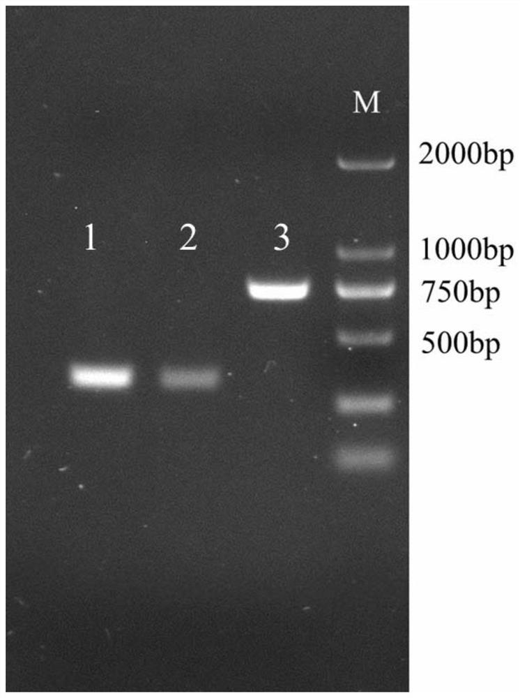 Anti-amantadine amd single-chain antibody scfv and its preparation method and application