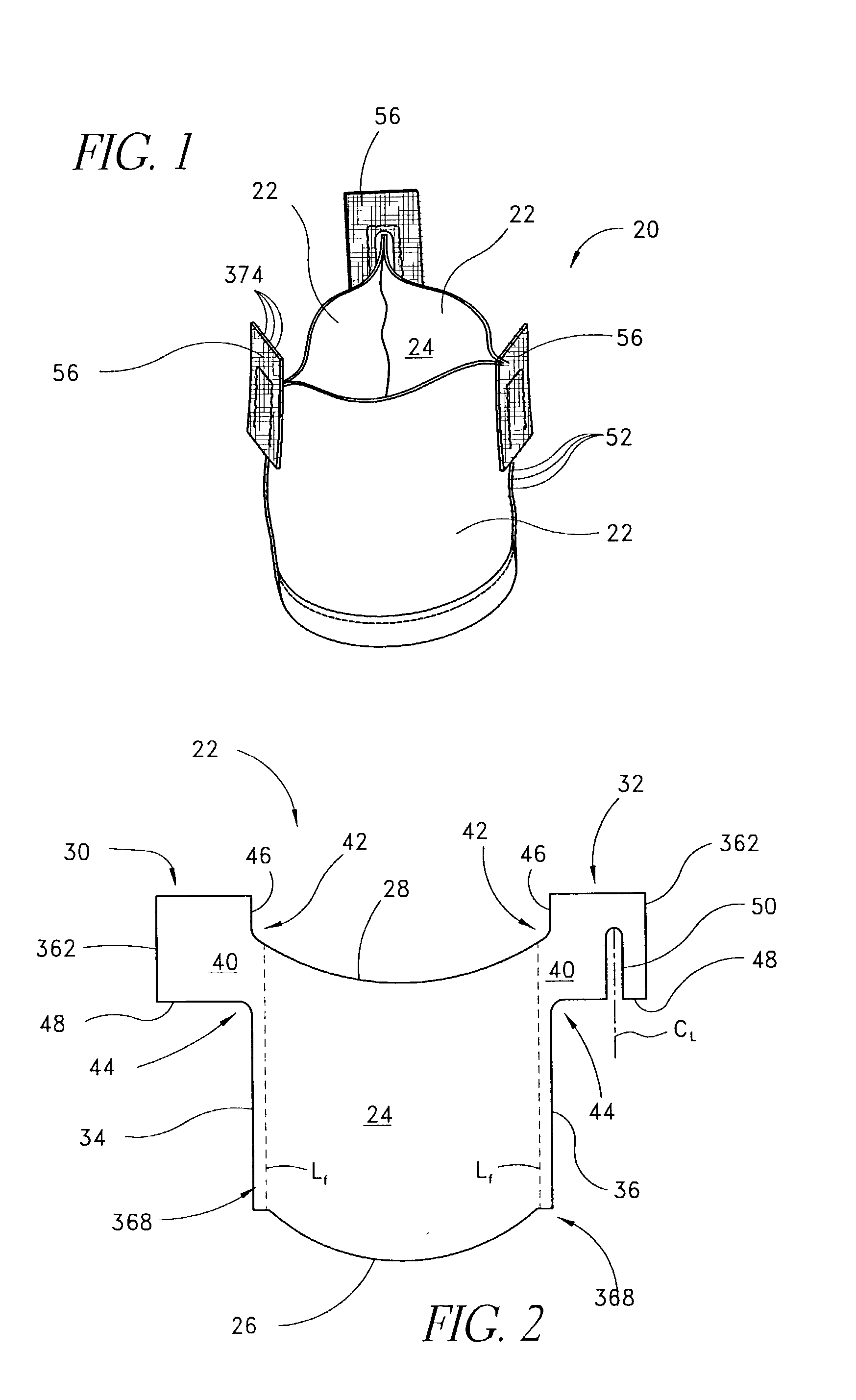 Method of cutting material for use in implantable medical device