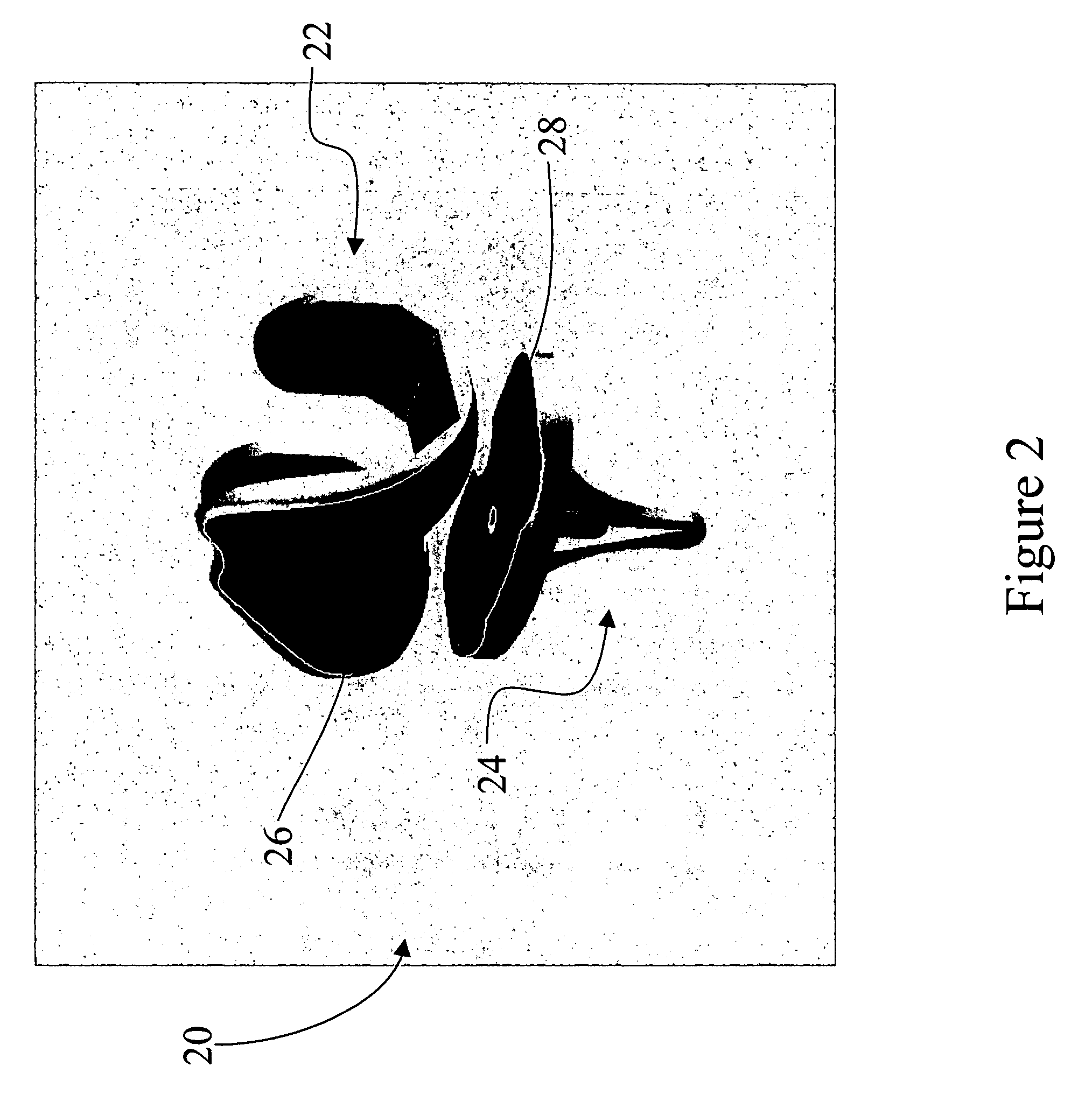Coated medical devices and methods of making and using