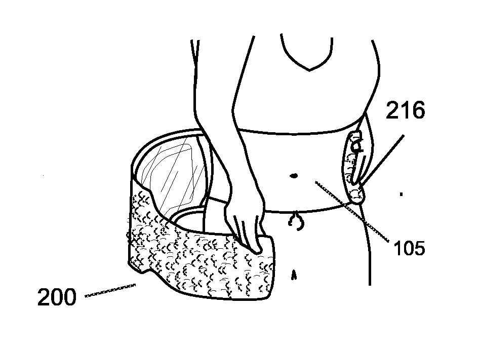 Weight Loss Method and Apparatus