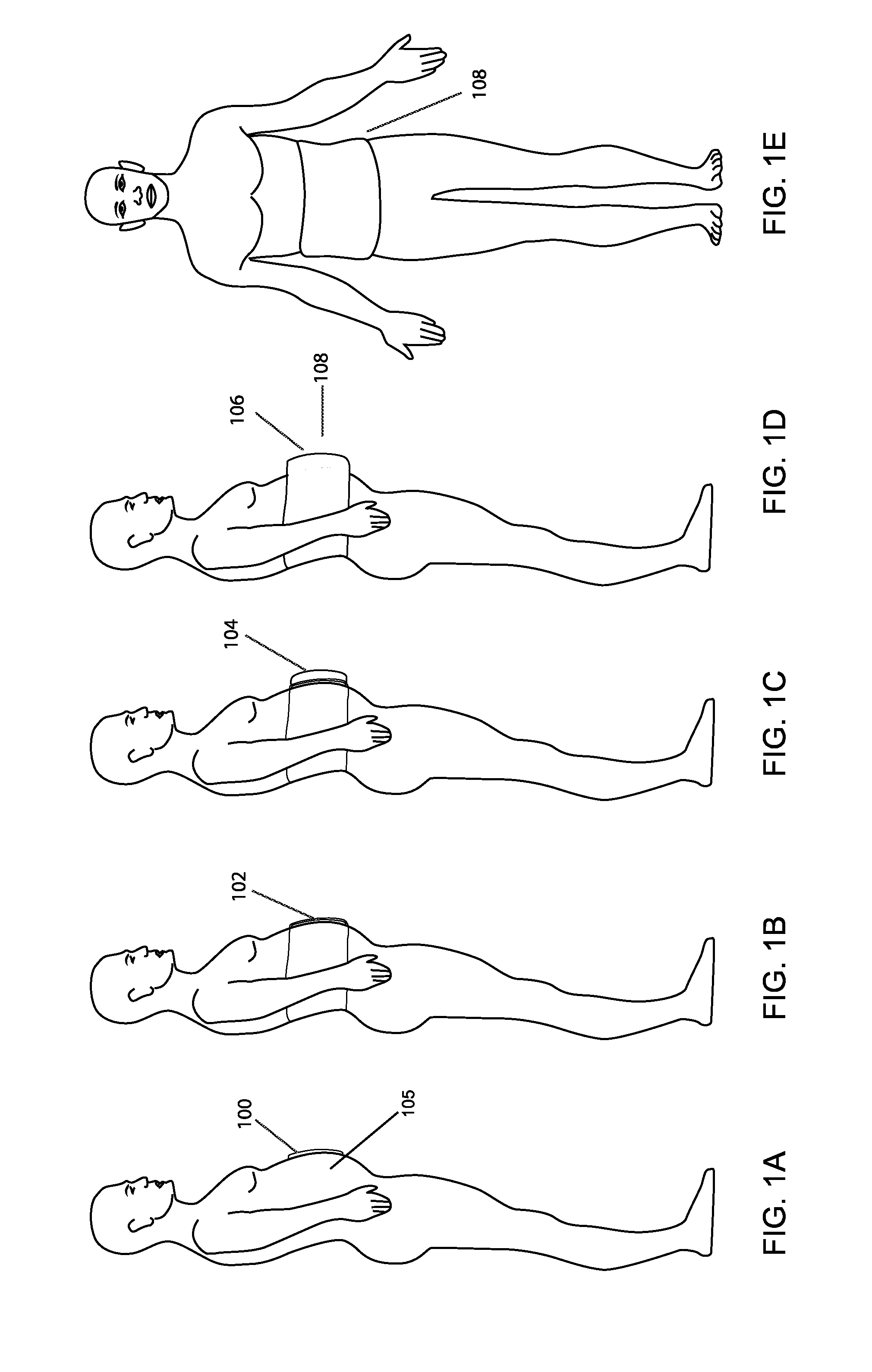 Weight Loss Method and Apparatus