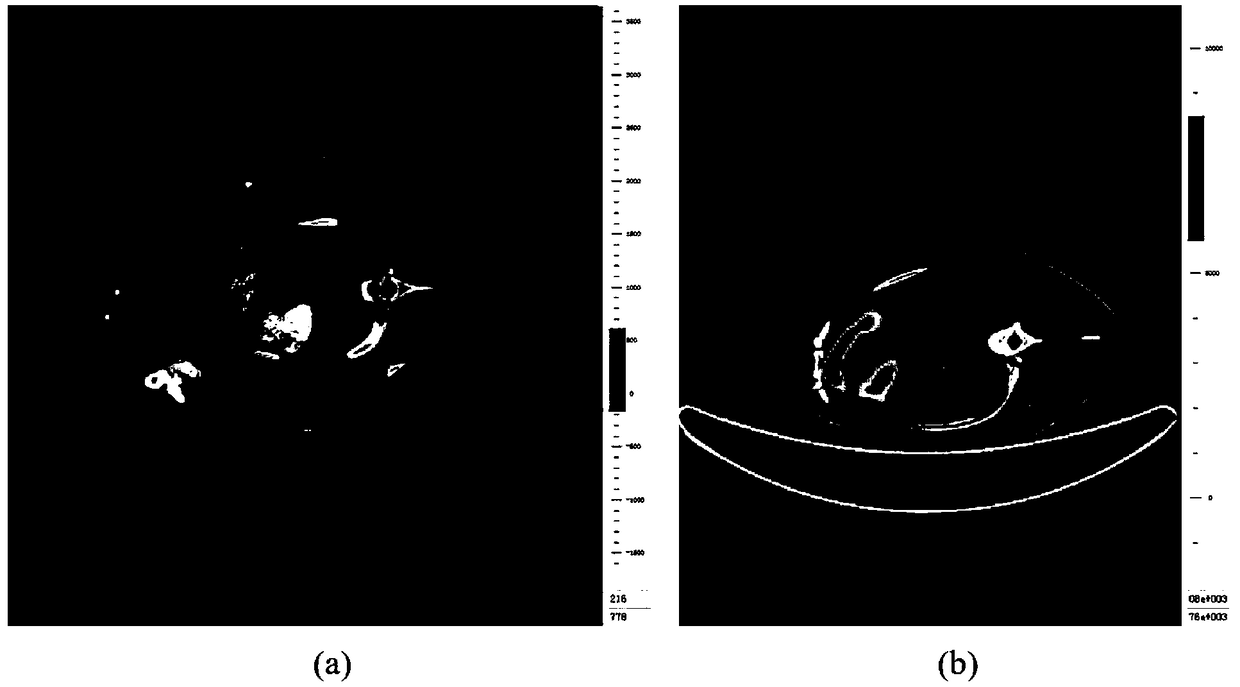 Method for quantitatively evaluating myocardial infarction on basis of nuclide image and CT (computed tomography) coronary angiography fusion