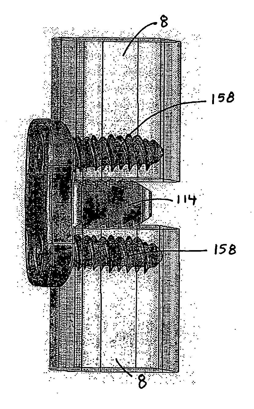 Flanged interbody fusion device with fastener insert and retaining ring