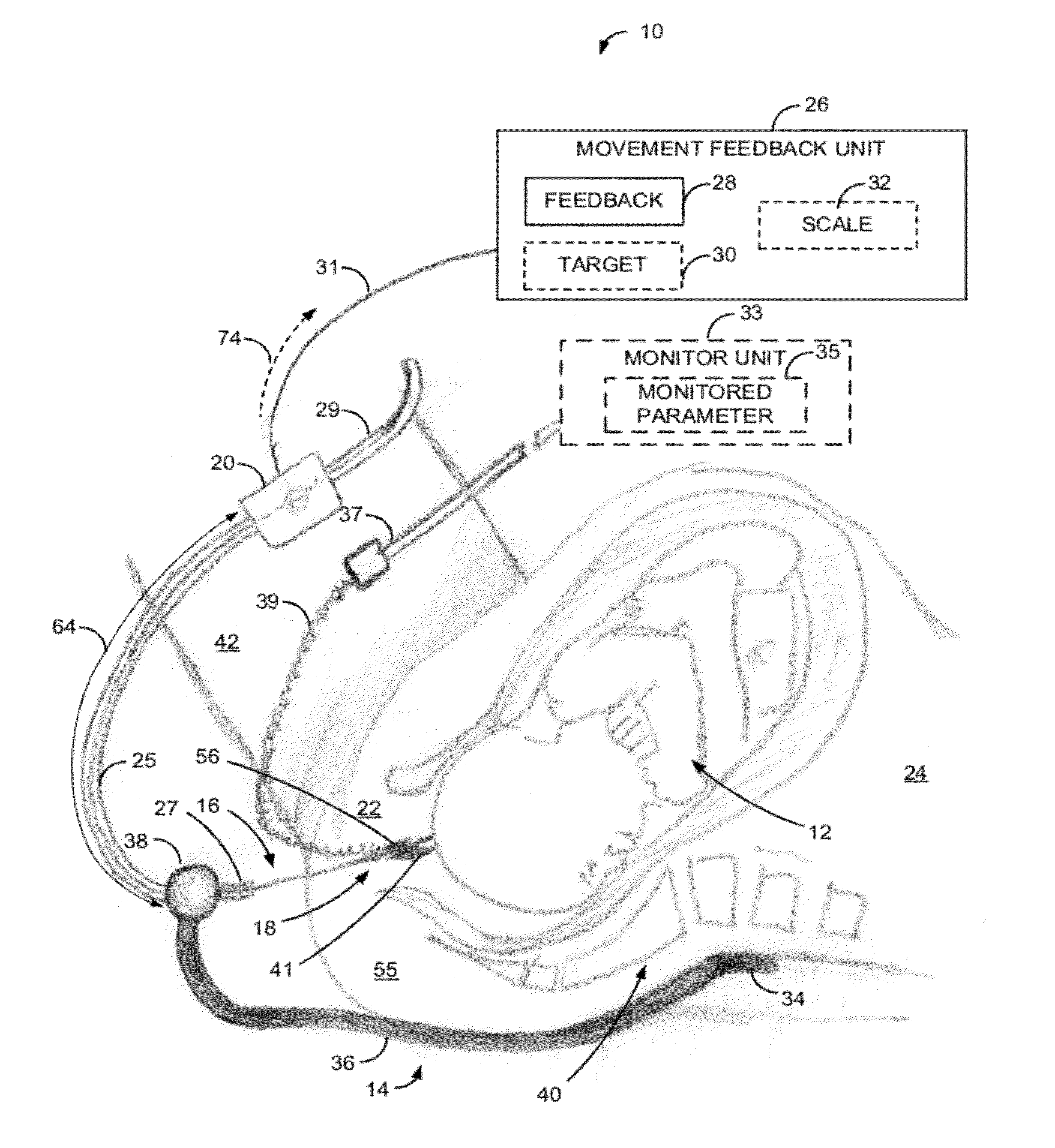 Apparatus and method of detecting movement of objects within the abdominal and/or pelvic region