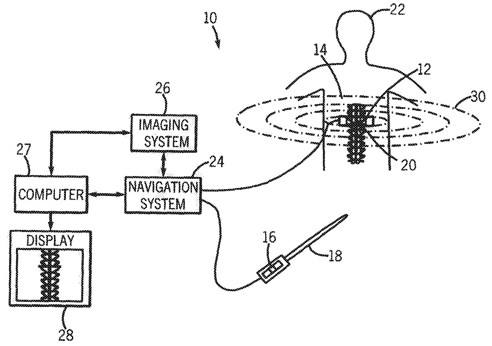 System and method for surgical navigation of motion preservation prosthesis