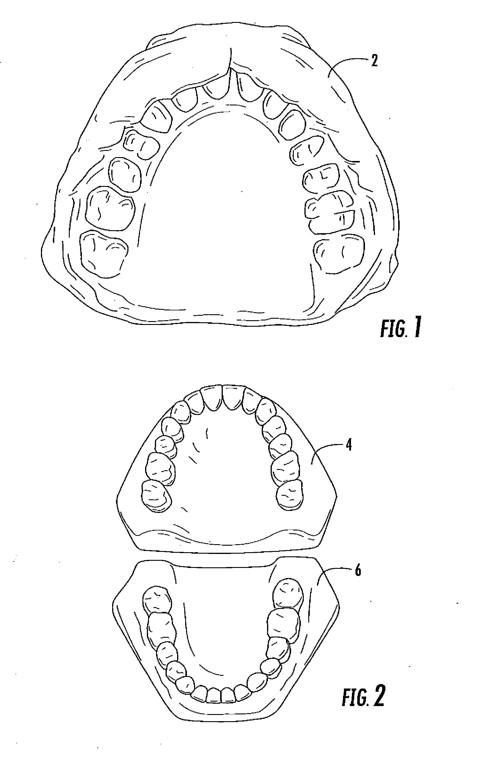 Concussion retarding orthotic and method of producing the orthotic